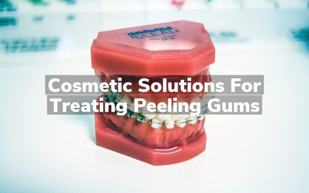 Cosmetic Solutions for Treating Peeling Gums