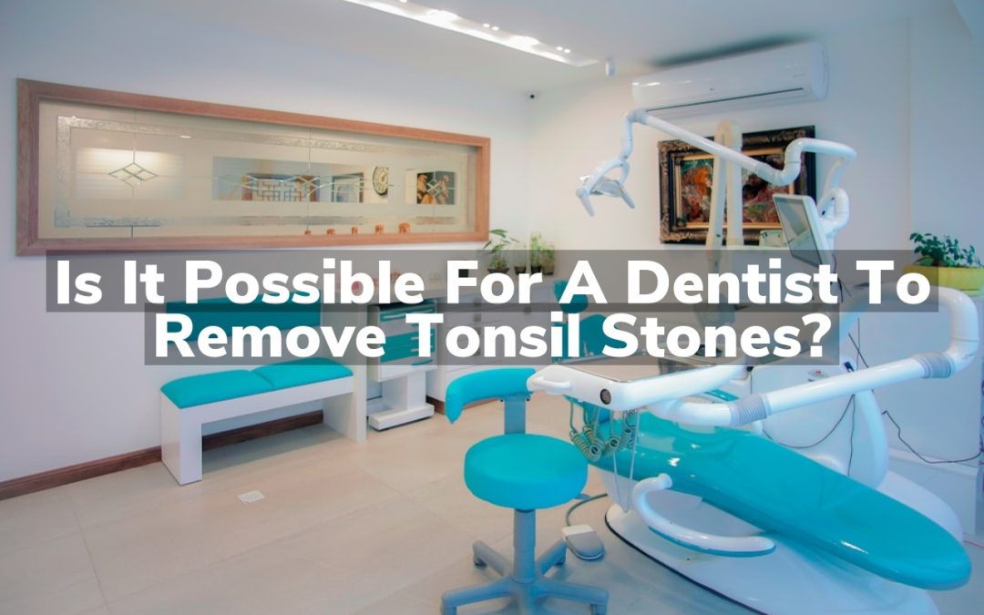 Is It Possible for a Dentist to Remove Tonsil Stones?