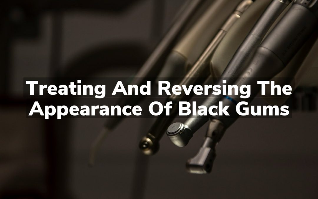 Treating and Reversing the Appearance of Black Gums