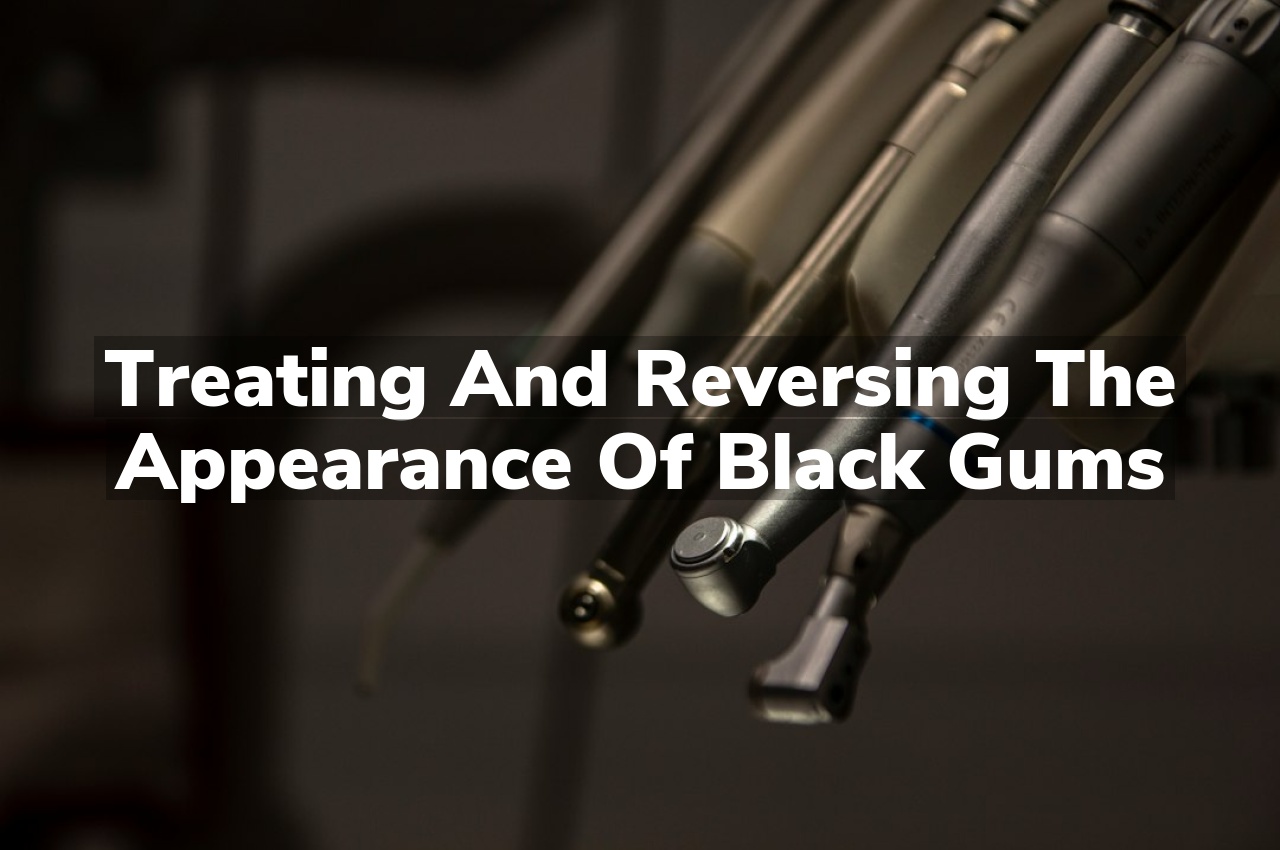 Treating and Reversing the Appearance of Black Gums