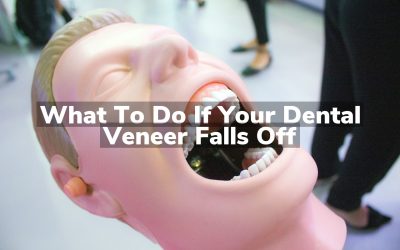 What to Do If Your Dental Veneer Falls Off