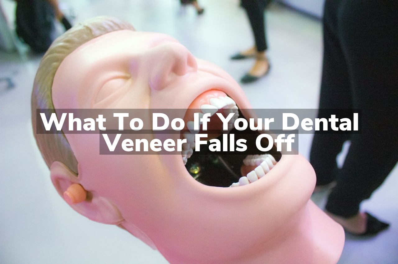 What to Do If Your Dental Veneer Falls Off