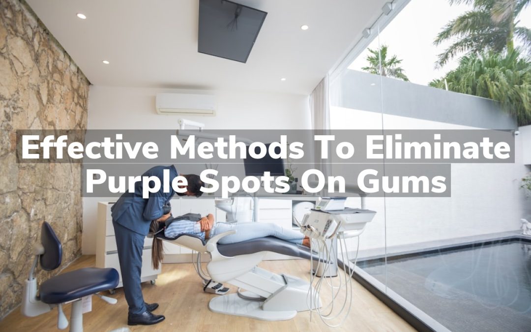 Effective Methods to Eliminate Purple Spots on Gums